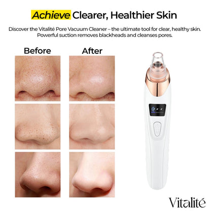 Pore Face Cleaner Vacuum